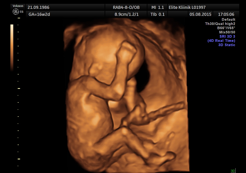 Картинки по запросу Все об УЗИ при беременности: 3D и 4D УЗИ,