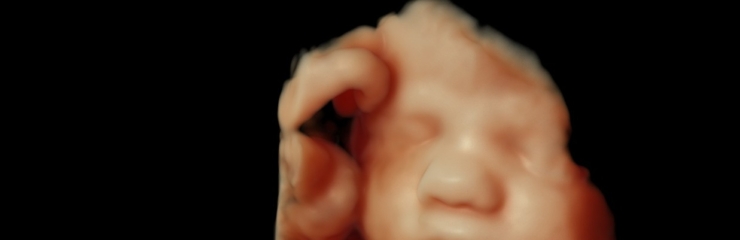 32+5_ultrasound_photo_EliteKliinik